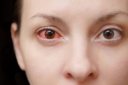 Oftalmologista Francisco Lima - crédito Higor Braga